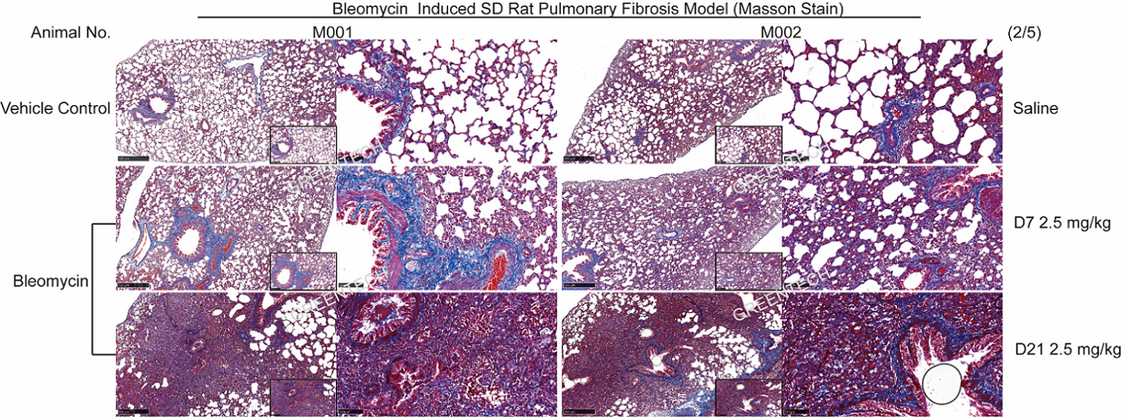 Lung section staining of bleomycin induced pulmonary fibrosis model in rats.png