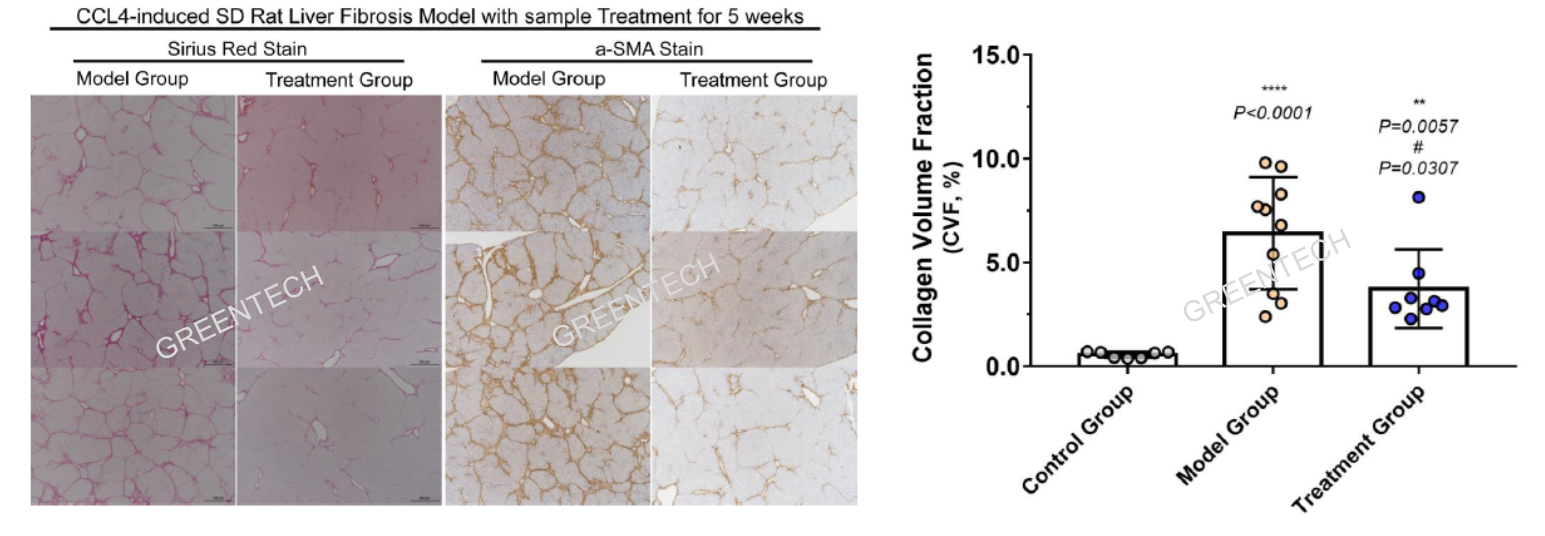 Collagen volume fraction of liver fibrosis model induced by CCl4 injection for 6 weeks.png