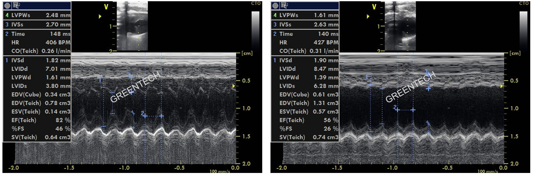 Echocardiographic measurements in SD rats before and one week after LAD ligation.png