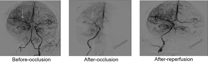 DSA showing the occlusion and reperfusion of the right middle cerebral artery of a Rhesus monkey.png