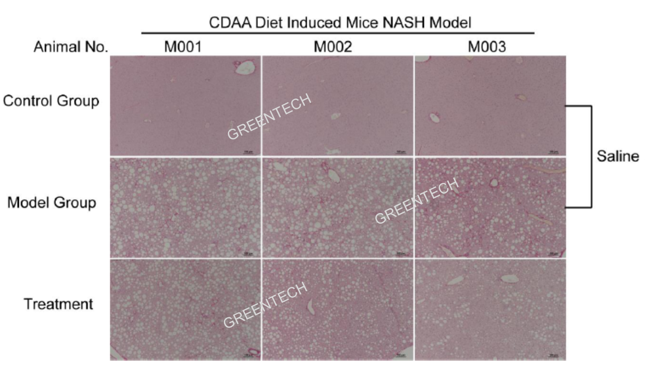 Liver histopathology of rodent NASH models induced by CDAA diet feeding for 8 weeks.png