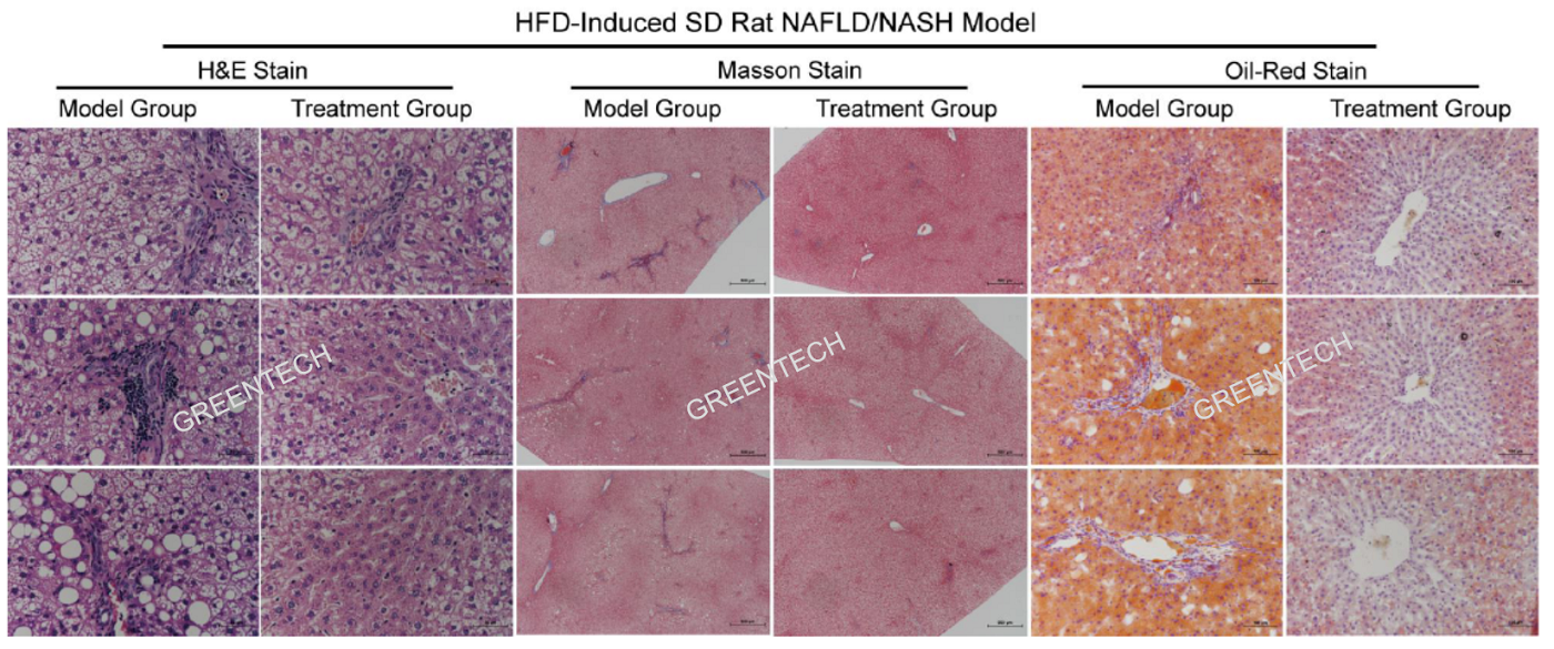 Liver histopathology of induced by HFD feeding for 12 weeks.png