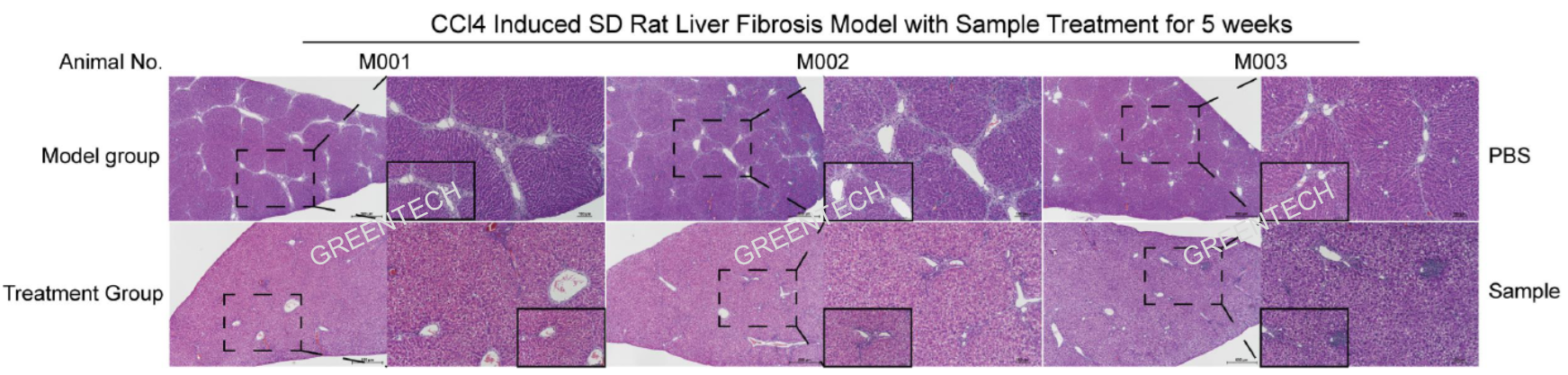 Liver histopathology of liver fibrosis model induced by CCl4 injection for 6 weeks.png