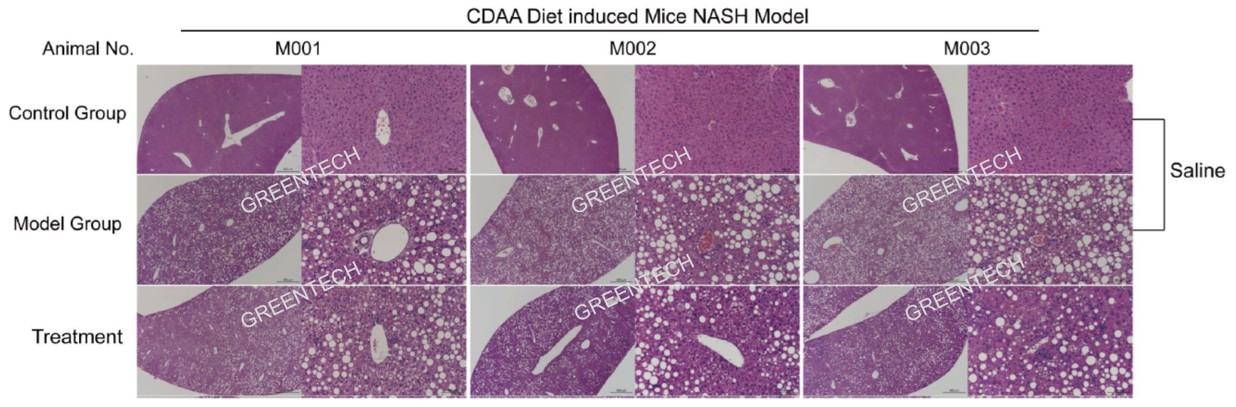 Liver histopathology of rodent NASH models induced by CDAA diet feeding for 8 weeks.png