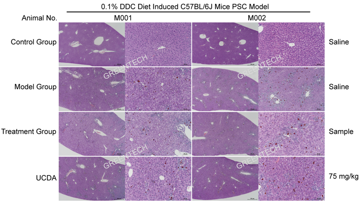 Hepatic histopathology (HE staining) of C57 mice feeding on 0.1% DDC diet for 8 weeks.png