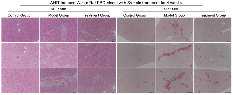 Hepatic histopathology of SD rats 4 weeks after ANIT induction.png