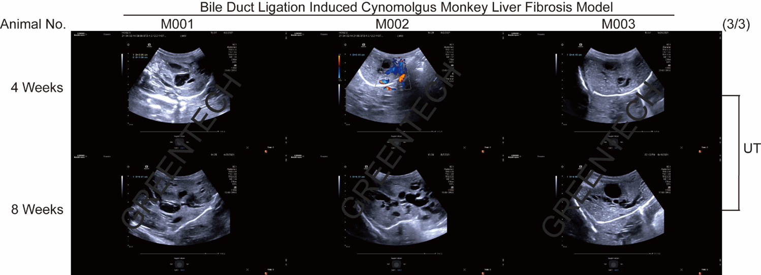 Ultrasound examination of liver fibrosis in cynomolgus monkeys after BDL.png