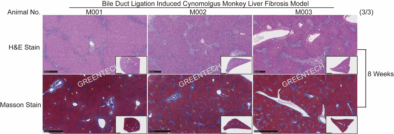 H&E and Masson staining demonstrated distinct cholestasis-induced model of liver fibrosis/cirrhosis in cynomolgus monkeys 8 weeks after BDL.png