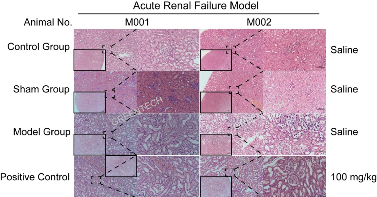 Partial aortic ligation induced acute renal failure model.png