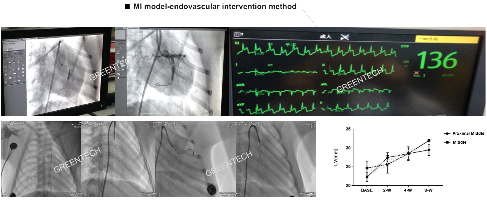 Myocardial infarction model-endovascular intervention method.png