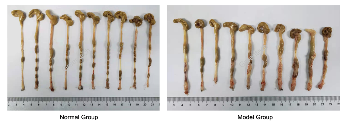 Appearance of intestines in TNBS induced colitis in rats.png