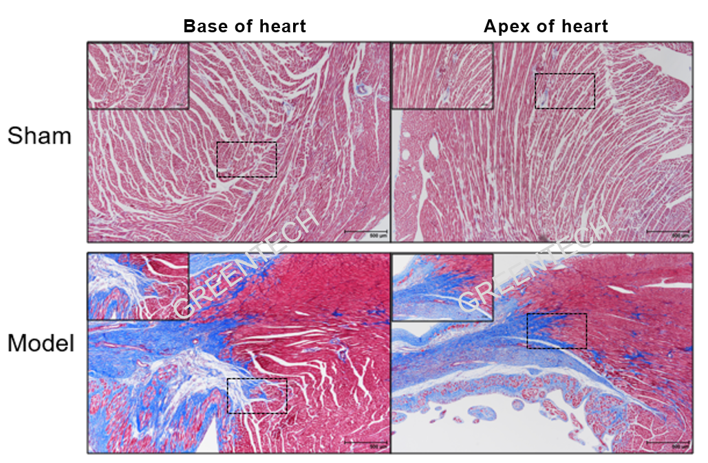 LAD ligation-induced myocardial infarction rats (Masson staining).png