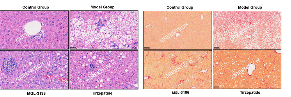 Hepatic histopathological alterations and fibrosis in the Gan diet induced obese mouse model.jpg